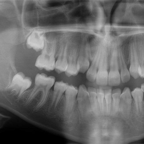 diagnostica-dentale