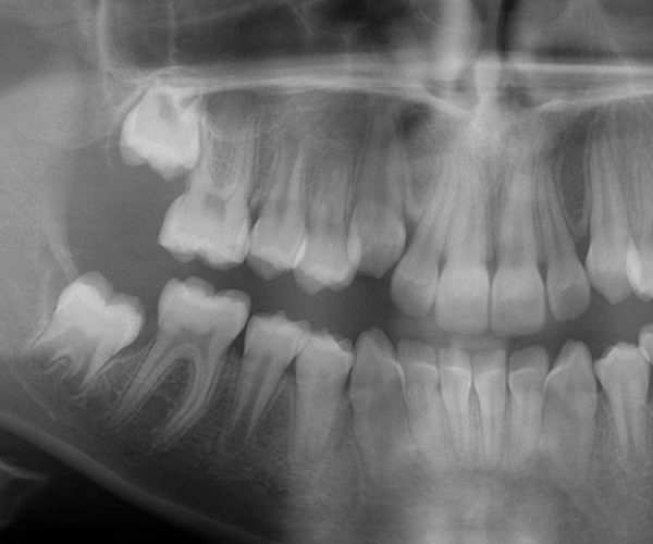 diagnostica-dentale